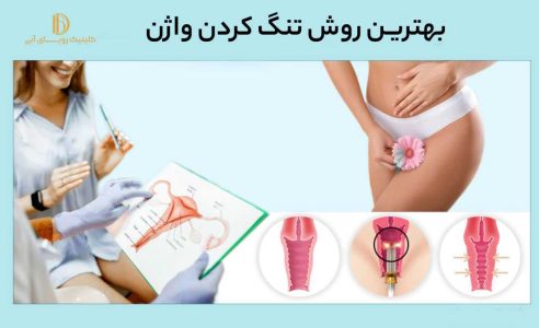 بهترین روش تنگ کردن واژن