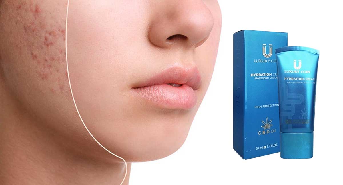 نحوه تشخیص کرم اصل و تقلبی لاکچری کوین